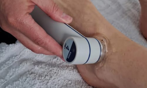 Electrotherapy & Ultrasound